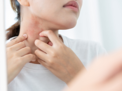 Woman itching her neck