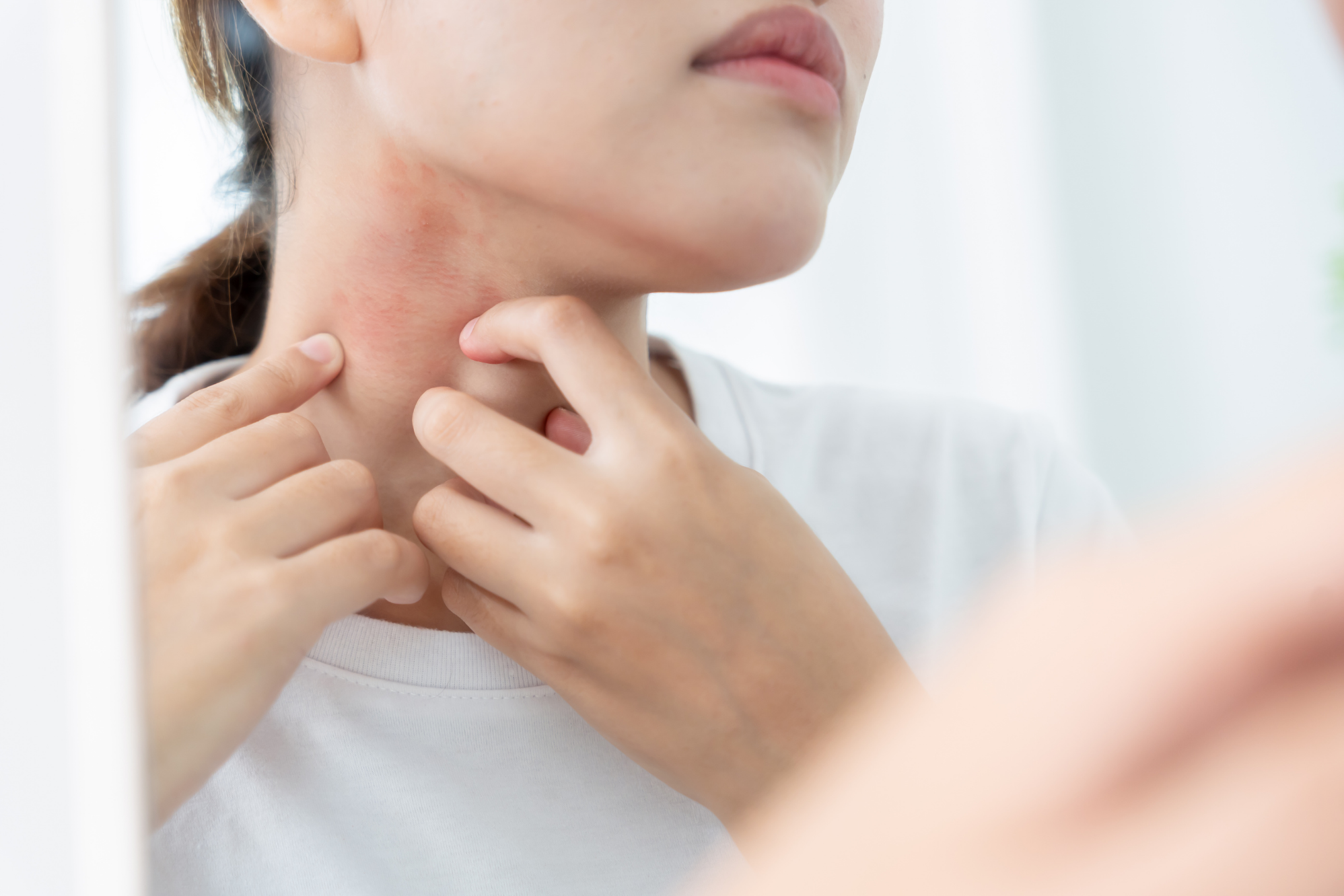 Woman itching her neck